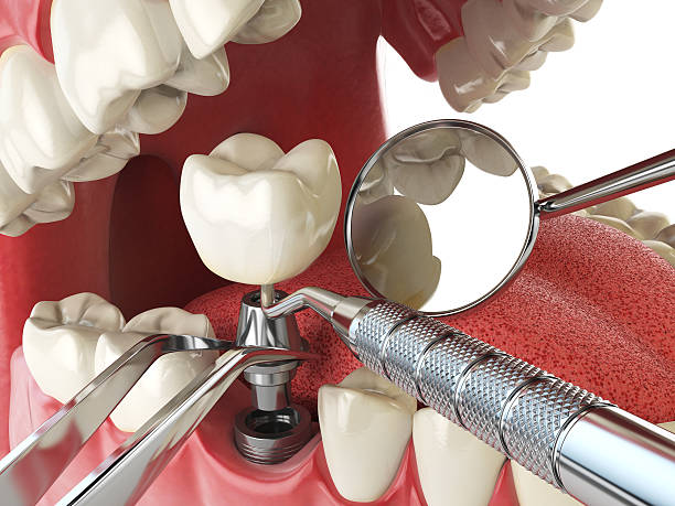 Best Emergency Broken Tooth Repair in Southmayd, TX