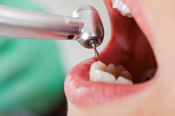 Best Emergency Treatment for Toothache in Southmayd, TX